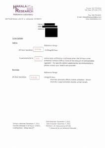 My Iodine Loading Test Results