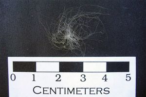 Unknown white fibers Unknown white fibers found during the 2002 excavation
