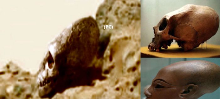 Elongated Skulls