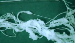 An example of "Angel Hair".