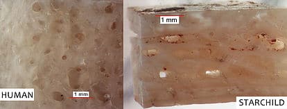 Differences in internal bone structure under the microscope. Note reddish residue in Starchild