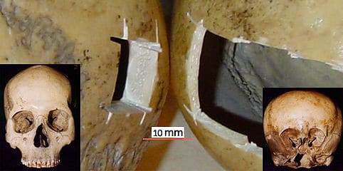 Starchild’s bone is 50% of the thickness of human bone... but much tougher.