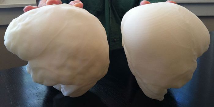 3D replicas of human brain and Starchild’s bigger brain (right) created from scans.