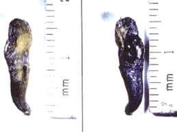 Implant after removal of membrane.