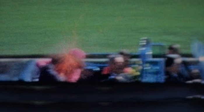 The picture that appears to show the shot that killed Kennedy came from the front